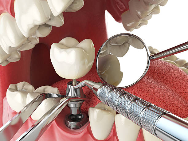 Best Emergency Dental Services for Seniors in Perry, UT